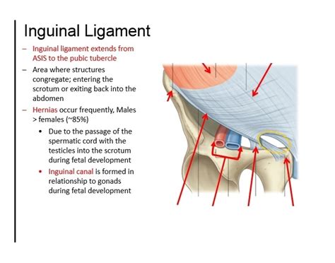 inguinal ligament injury